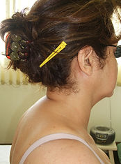 antes.jpg