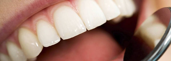 teeth.jpg