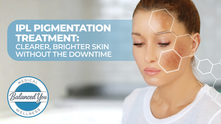 Promotional image for IPL pigmentation treatment in Omaha at Balanced You Medical Wellness showing a woman’s face with highlighted pigmentation areas and text reading ‘Clearer, Brighter Skin Without the Downtime.