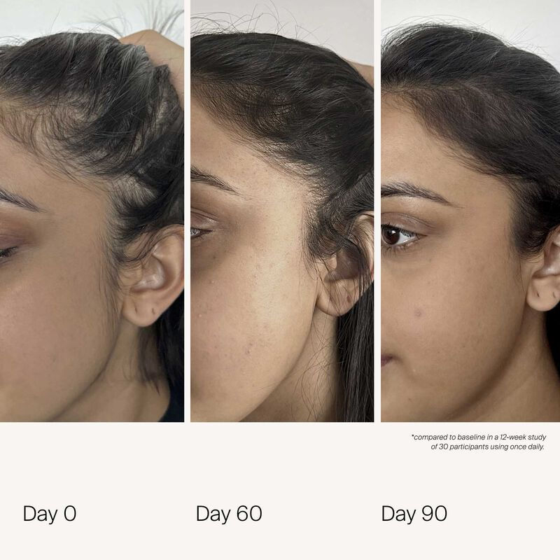 Thumbnail: Scalp Care Density Serum