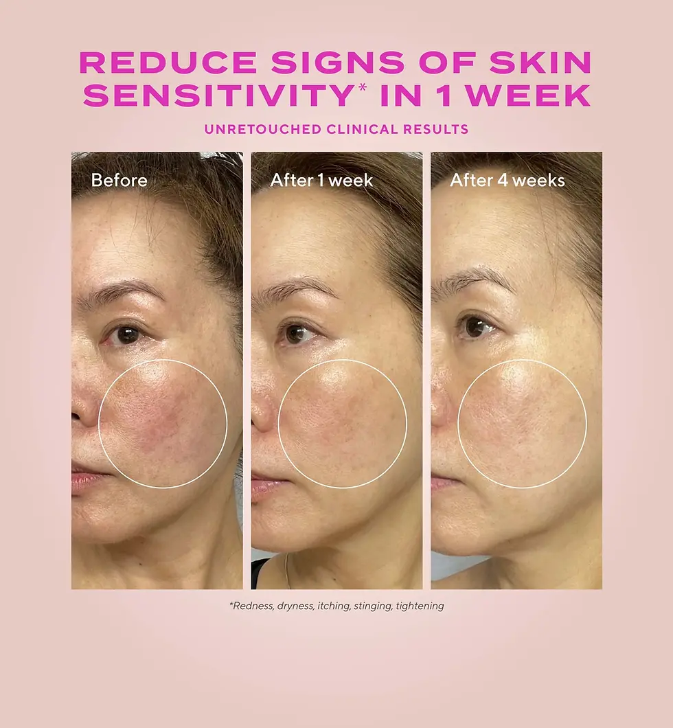 Thumbnail: Heartleaf Gentle Resurfacing Serum