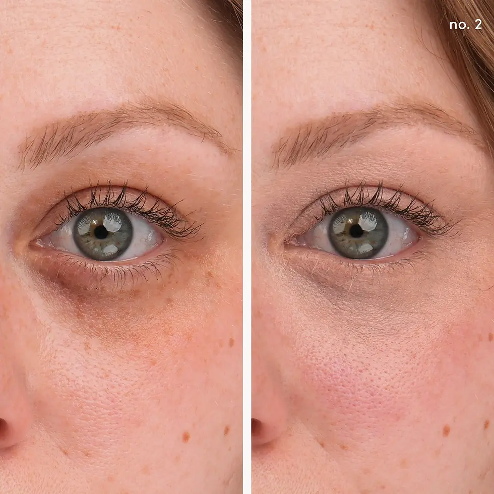 Thumbnail: Circle\Delete Concealer