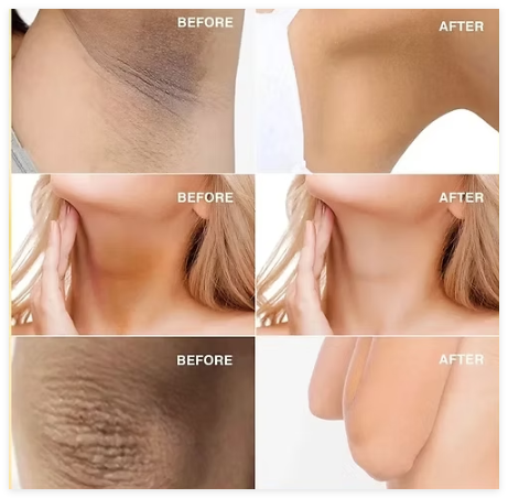 Thumbnail: Hand Made Turmeric Soap Body Cleaning Lightening Dark Underarm Leg Body SKU: -32