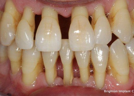 Oral health: A window to your overall health