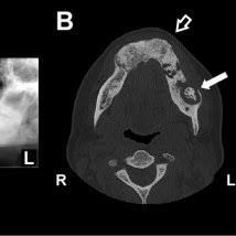 All about CT, MRI and intral oral scanners in dentistry