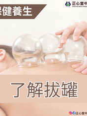 【保健養生】了解拔罐