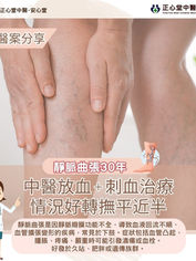 【醫案分享】靜脈曲張 — 配合中醫放血治療