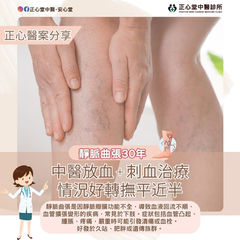 【醫案分享】靜脈曲張 — 配合中醫放血治療