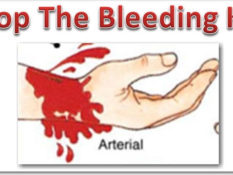 How to make a Stop the Bleeding Kit!