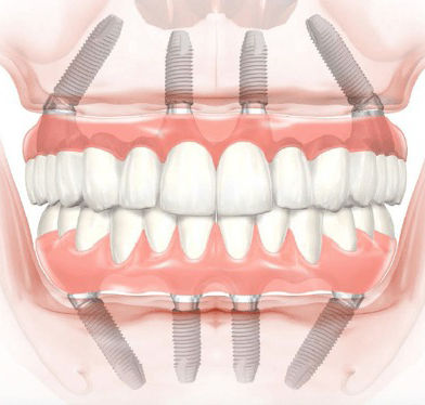 Manual-de-Procedimento_imagem-1.jpg