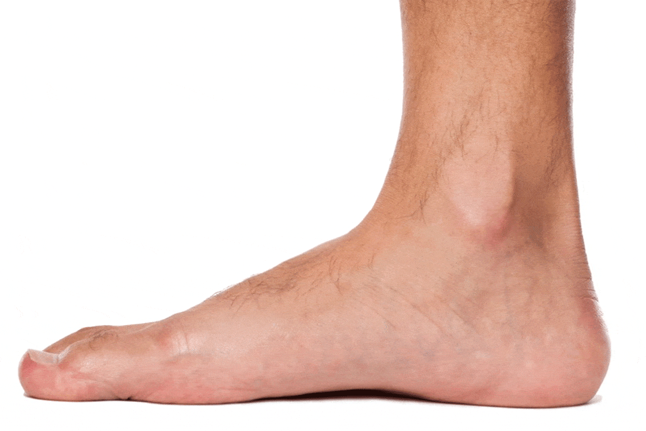 how-to-fix-flat-feet.gif