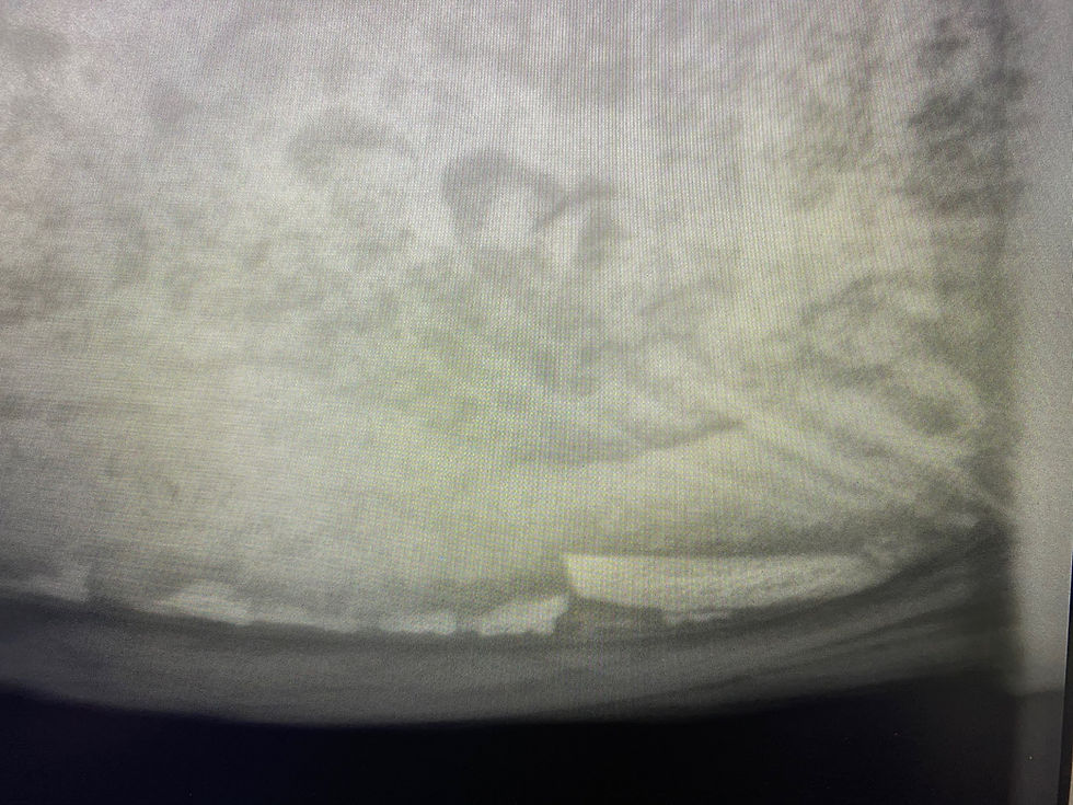 Thumbnail: Poskom AirRay-20 Xray Generator