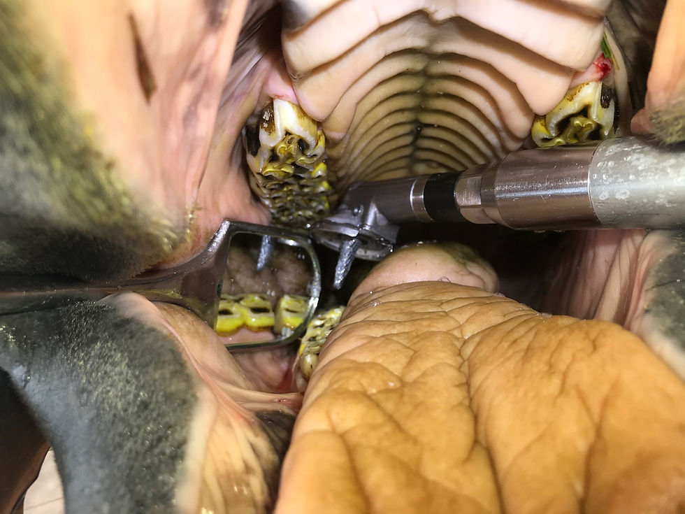 Thumbnail: Diastema Burr Slimline