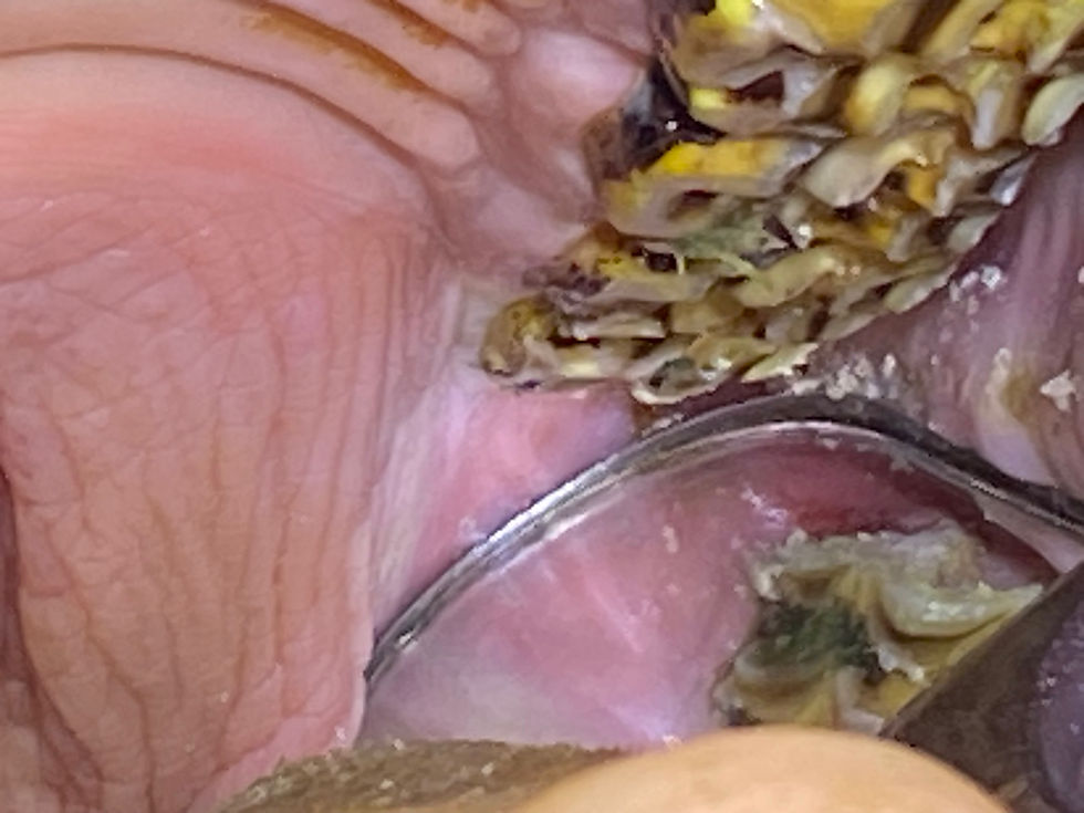 Thumbnail: Pf Apple Core Diamond Burrs