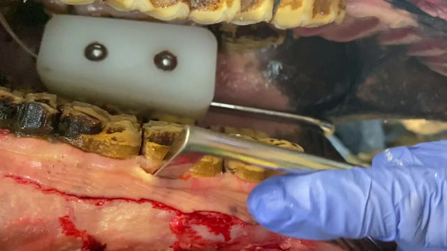 Thumbnail: Cheek Teeth Mucosal Elevator