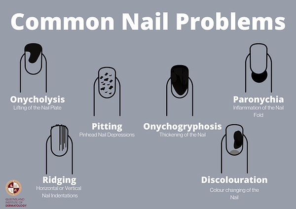 _Types of Nail Problems (1).png