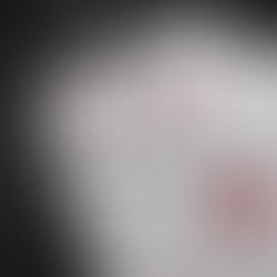 Business Idioms with 'ace'