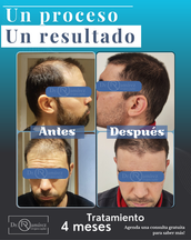 Tratamiento capilare
