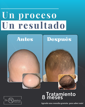 tratamiento capilar dr ernesto