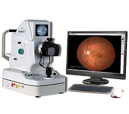 Retinal Photography