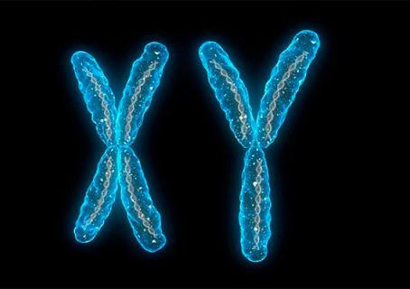 Pérdida del cromosoma ´Y´ aumenta el riesgo de Alzheimer