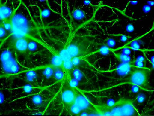 Astrocitos: los guardianes invisibles del cerebro