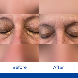 BSLC Before & Afters.png