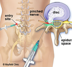 X-Ray6.jpg