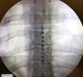 X-Ray.PNG