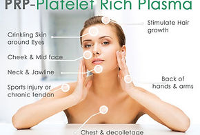 Medical SPA, Skincare, Skin care, Laser, Coolsculpting, Ultherapy, Vampire Facial, PRP facelift, Botox, Dermal filler, Facial, Hair Restoration, Microneedling, Microdermabrasion, facial rejuvenation, Spider vein, Wellness, Westchester, Scarsdale, Bronxville, Eastchester, Tuckahoe, Poughkeepsie, Dutchess