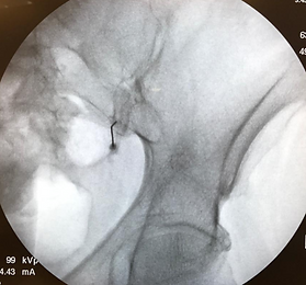 X-Ray4.PNG
