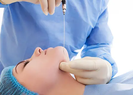 liposuction Chin 2.webp