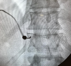 X-Ray 3.PNG