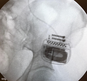 X-Ray 4.PNG