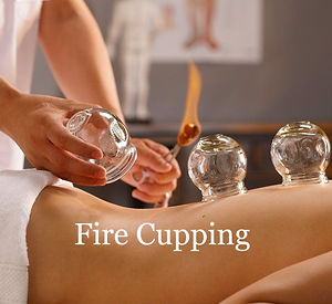 fire cuppings pic.jpg