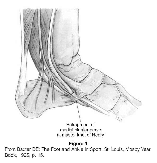 Lower Limb Surgery Medial Plantar Nerve Entrapment (Jogger’s Foot)