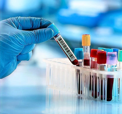 Toma de Muestras De Laboratorio Clinico