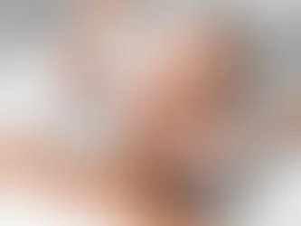 🤔 Cosas que (quizá) no sabías sobre el ácido hialurónico… ¡en odontología!