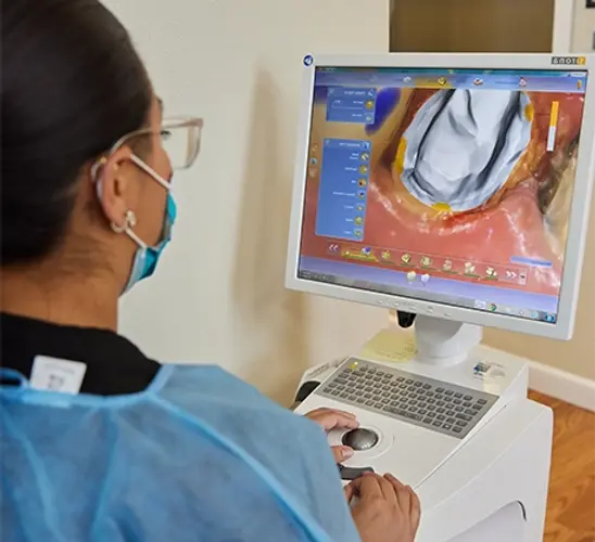 advance-dental-technology-cerec-crowns-santa-barbra-family-dentistry-santa-maria-ca.webp