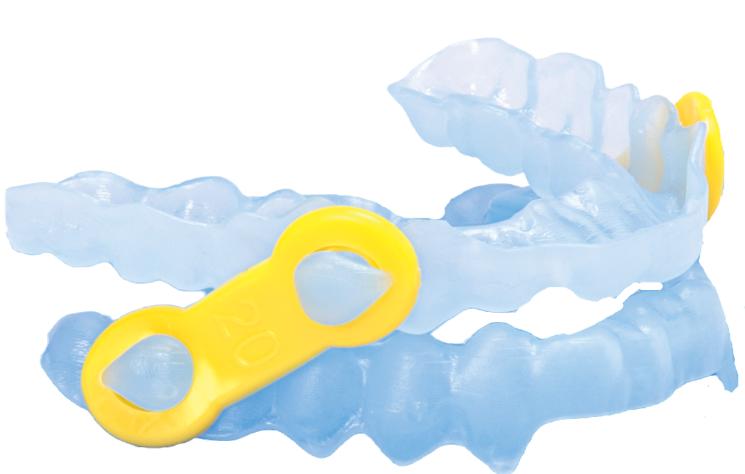 Thumbnail: ema CAD and Milled sleep appliance and snore guard for sleep apnea, OSA and snoring