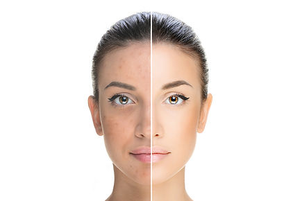 Laserterapia em Bauru