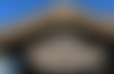 矯正後のリテーナー