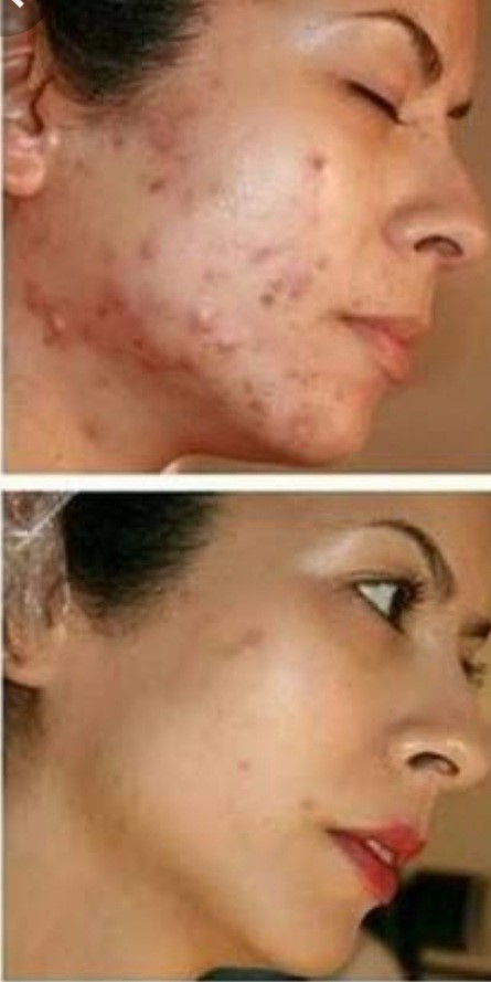 Foto tomada de la web