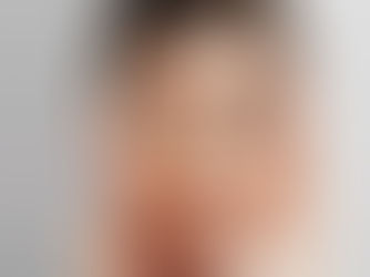 ¿Cómo aclarar la piel de manera saludable?