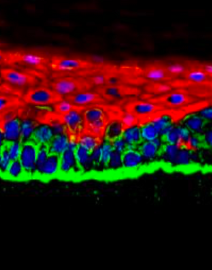 Accelerated in vitro skin graft. By V Jayarajan, 2022.