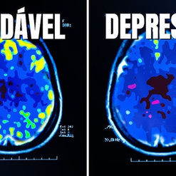 PROCESSO QUÍMICO DA DEPRESSÃO : IMPACTO NO CORPO E NA MENTE