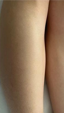 STORY SKINELYS (1).png