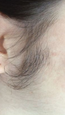 STORY SKINELYS (4).png