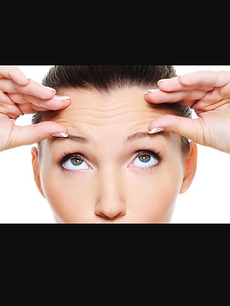 forehead.PNG
