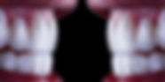 Voss-Detal-Veneers-1152-×-576-px.jpg